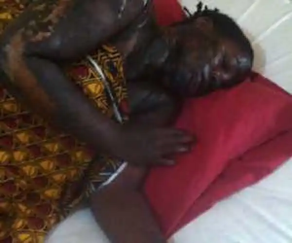 Photo: 27-Year-Old Woman Dies After Acid Attack By Boyfriend In Benue State